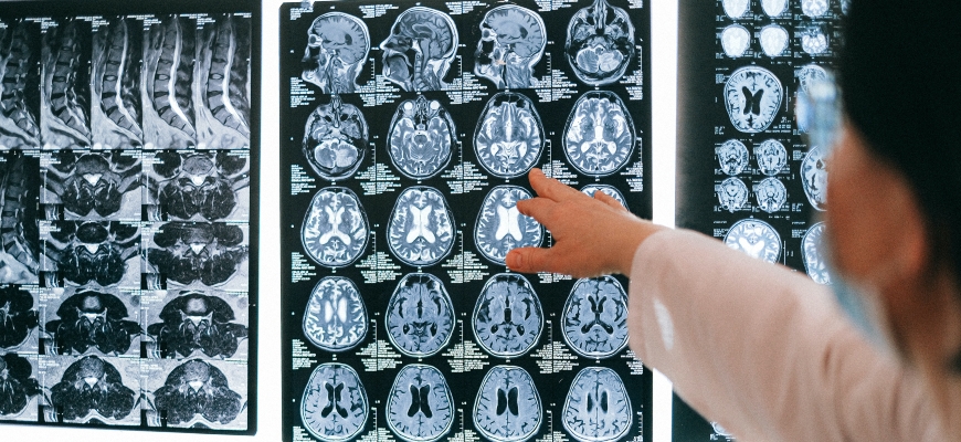 SPAVC premeia investigações sobre doença vascular cerebral
